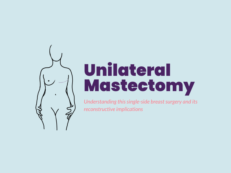 Understanding Unilateral Mastectomy